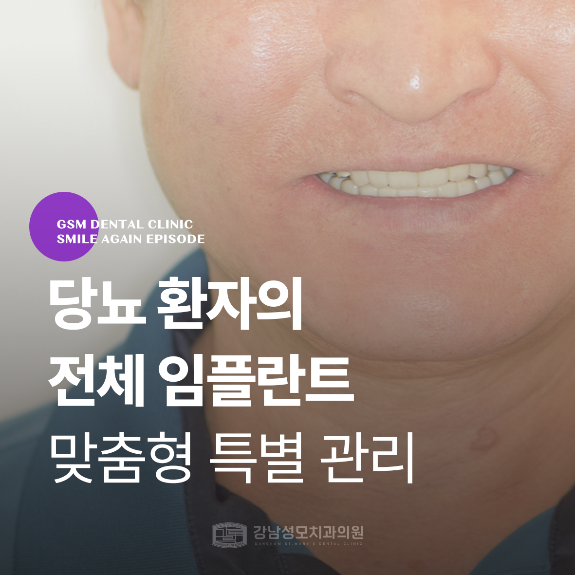 강남성모치과 증례 썸네일 견진석님