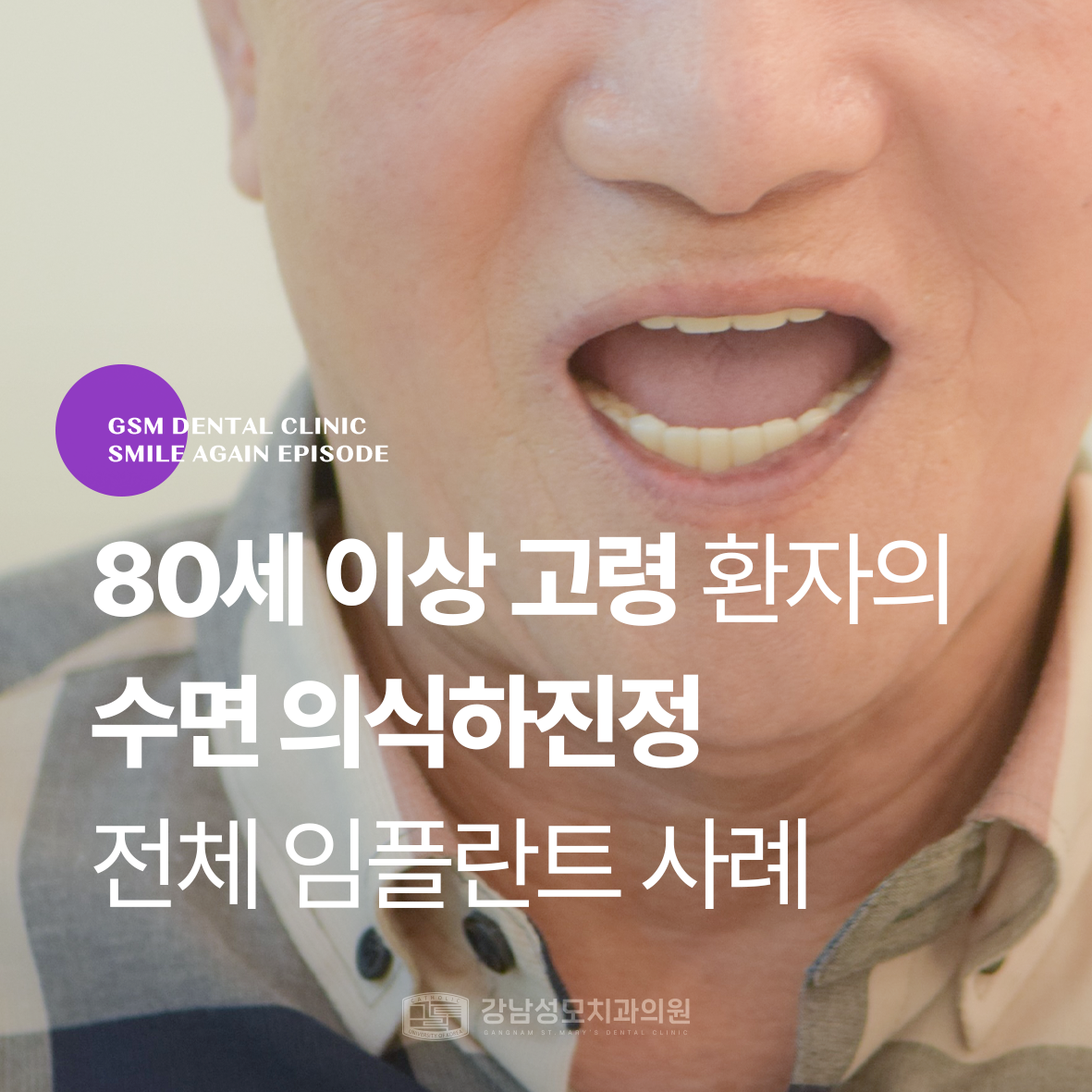 강남성모치과 증례 썸네일 김동근님