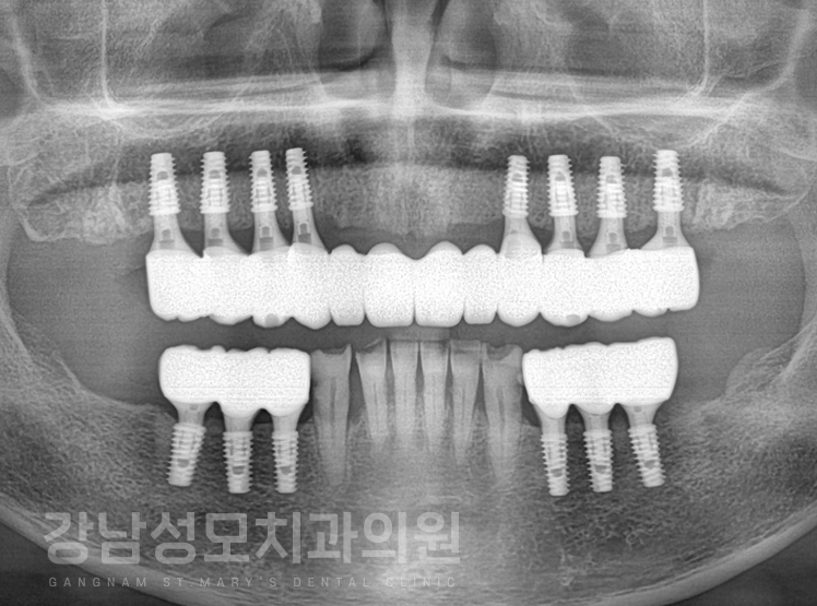 657ac456a80e32637118